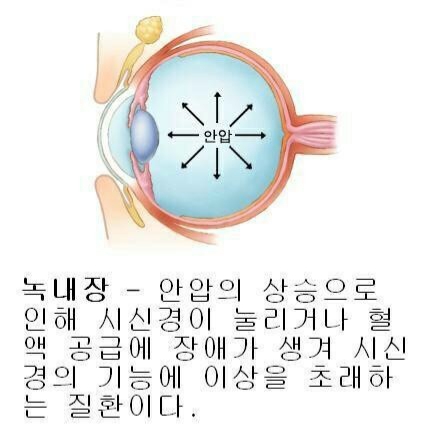 유니플러스비전 이미지