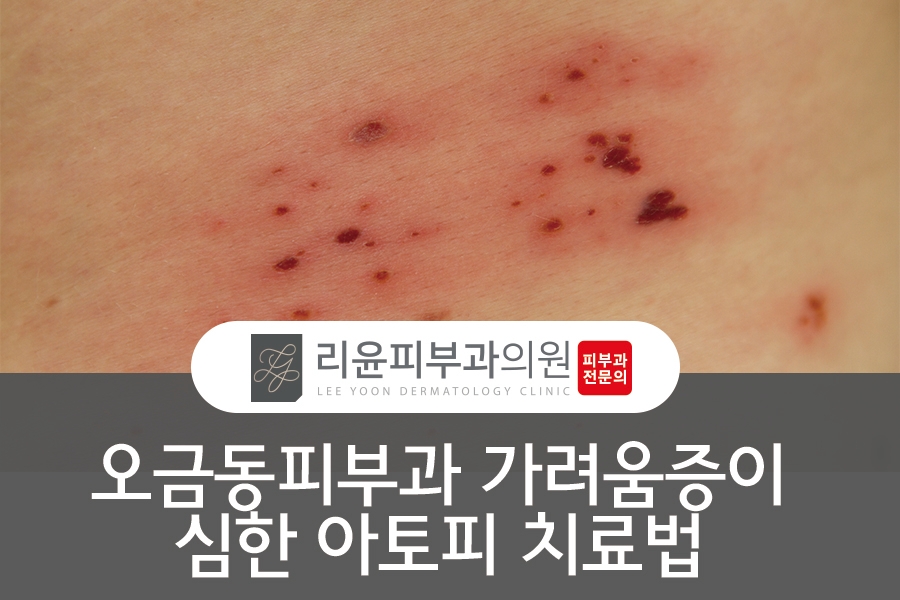 리윤피부과의원 이미지