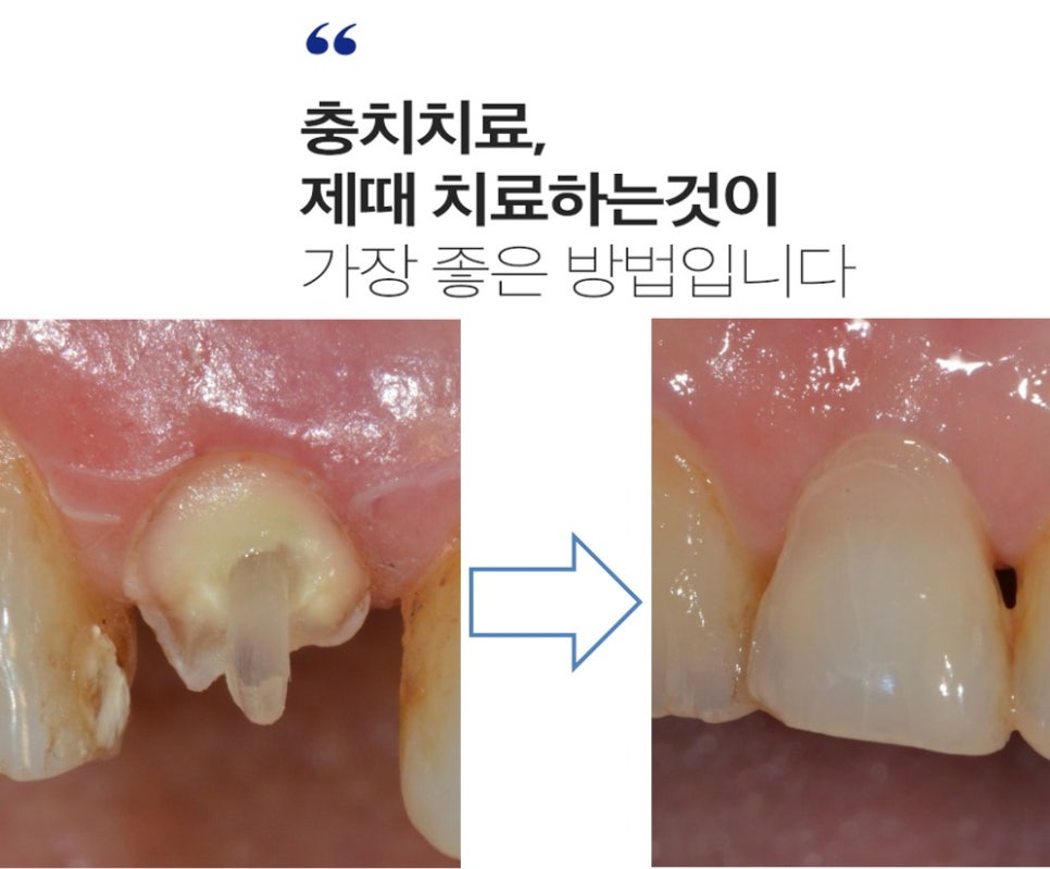 탄탄치과 이미지