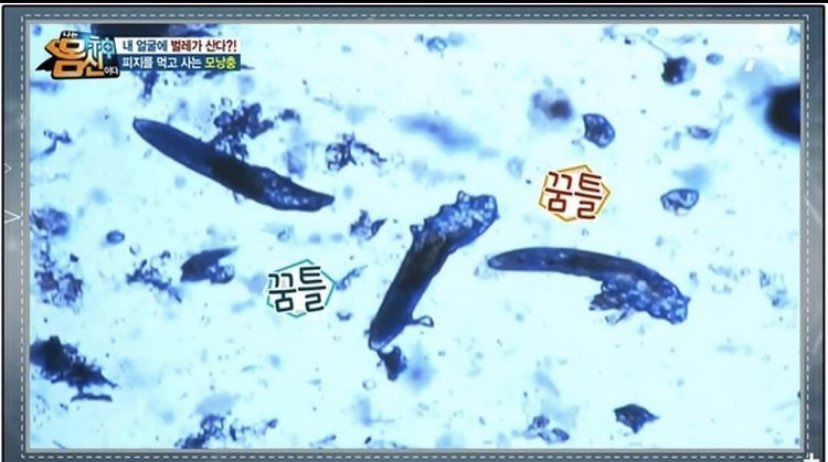바로바디 이미지
