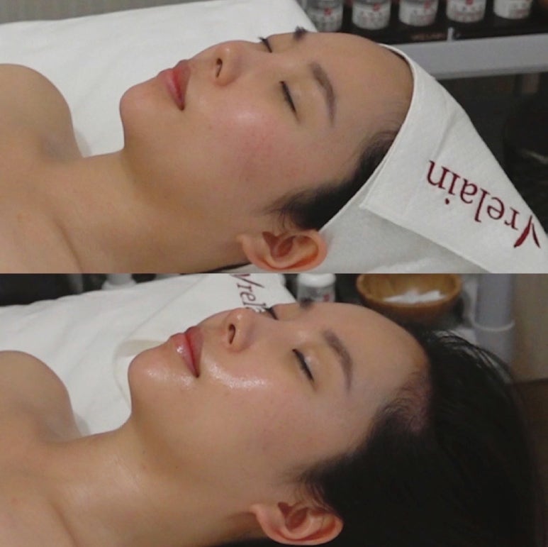 차크라에스테틱 이미지