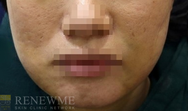 리뉴미피부과 이미지