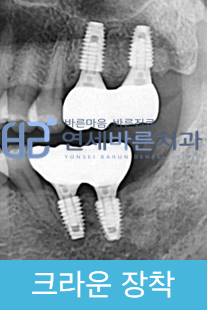 연세바른치과 이미지