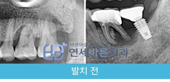 연세바른치과의원 이미지