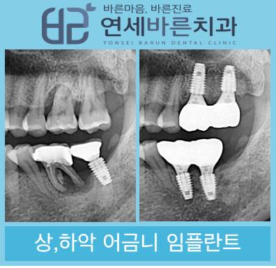 연세바른치과의원 이미지