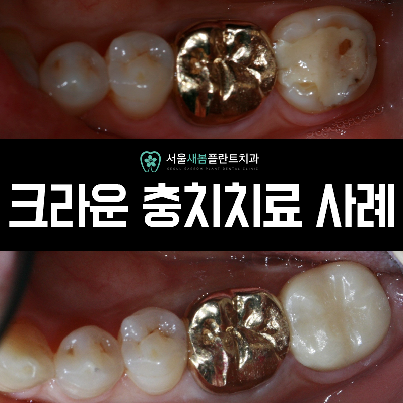 서울새봄플란트치과의원 이미지