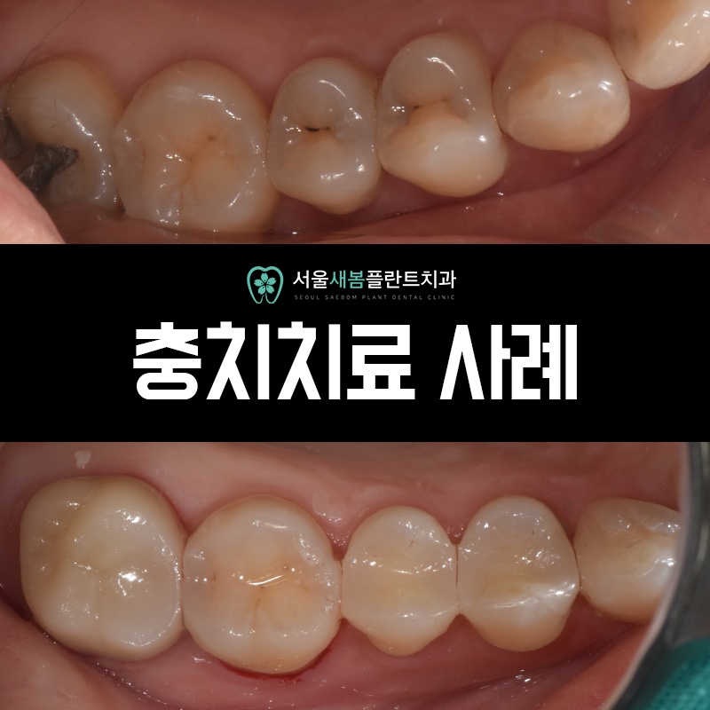 서울새봄플란트치과의원 이미지