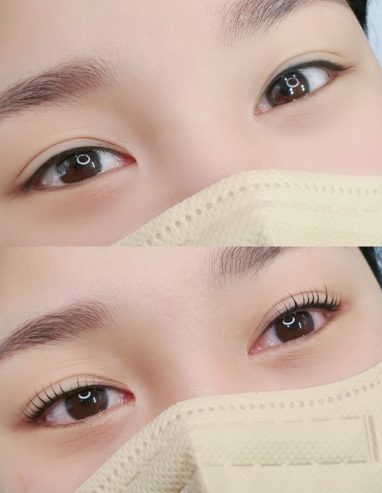 요니뷰티 이미지