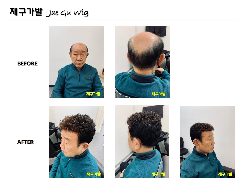 재구가발 이미지