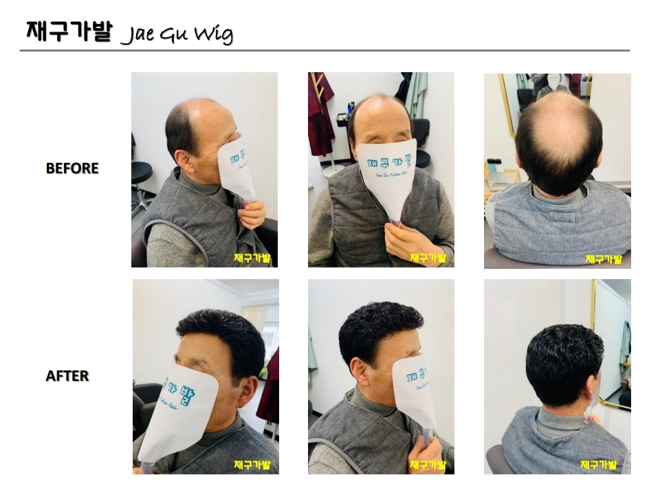 재구가발 이미지