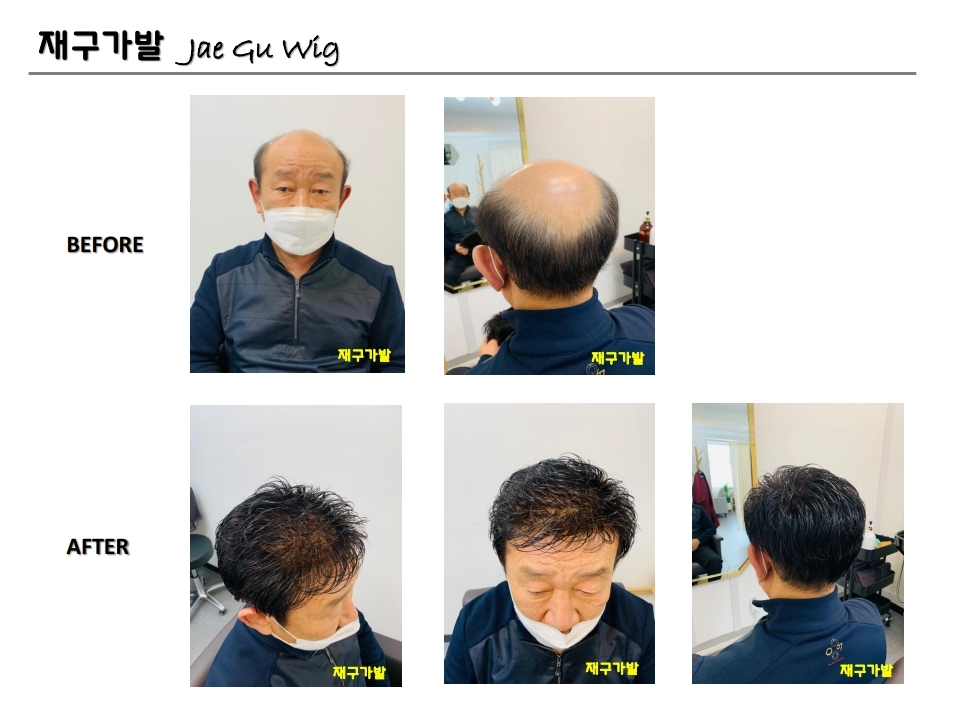 재구가발 이미지