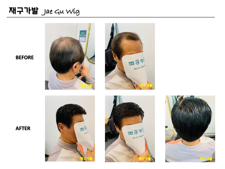 재구가발 이미지