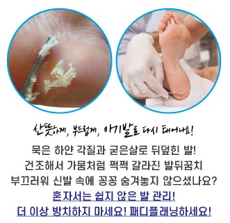 쏘야네일 이미지