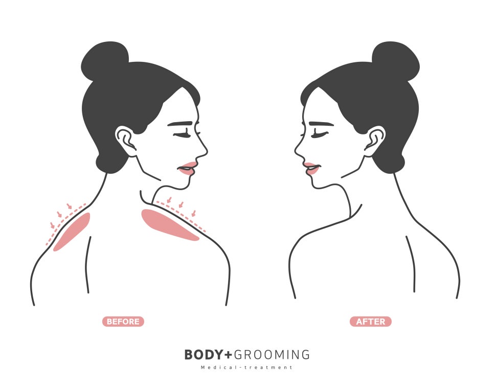 진바디핏 이미지