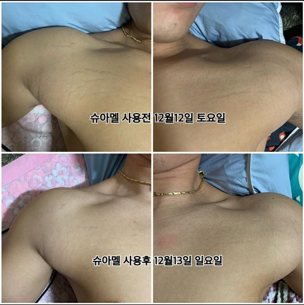 인셀덤 대구 이미지
