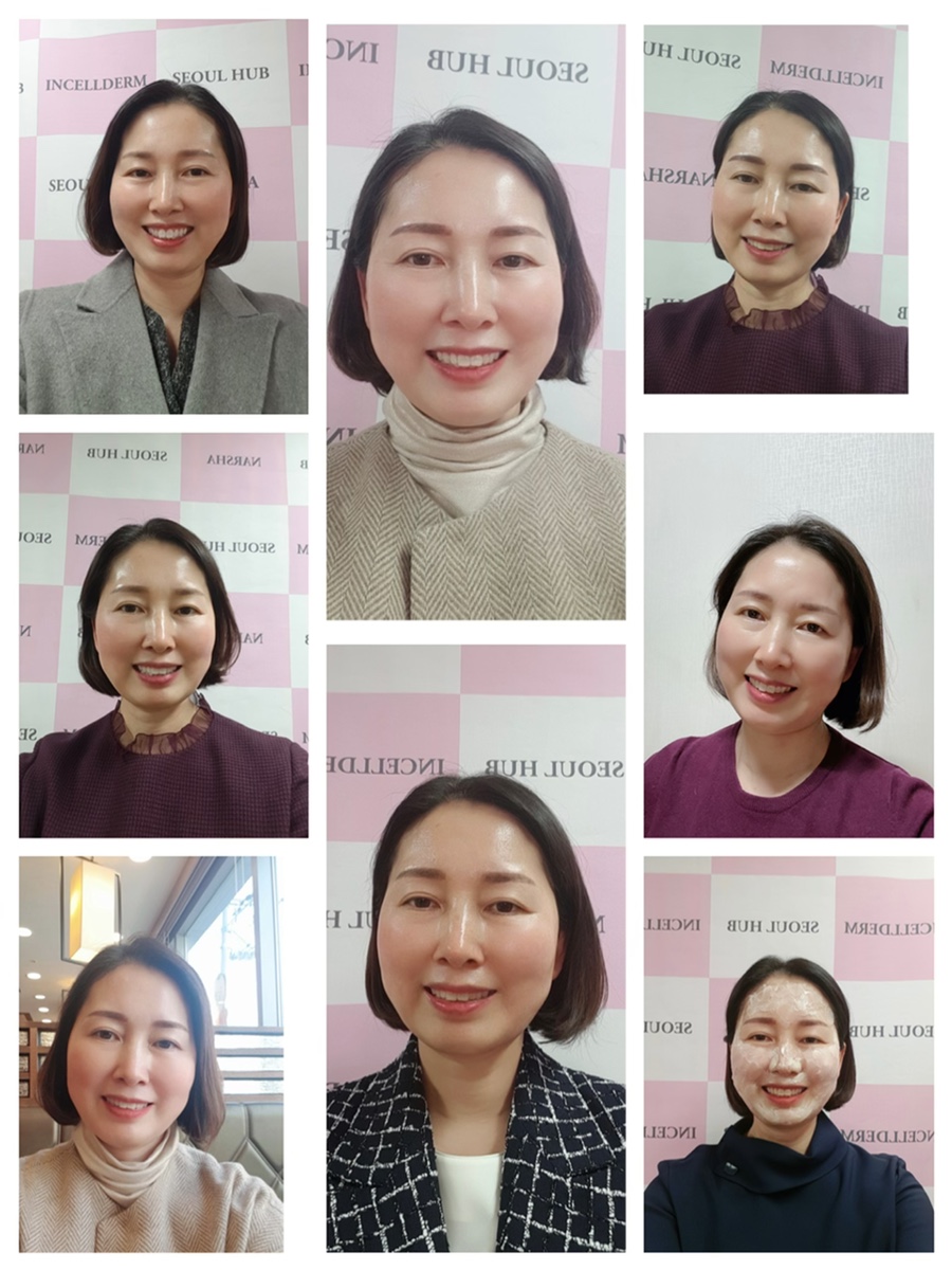 인셀덤미소 이미지