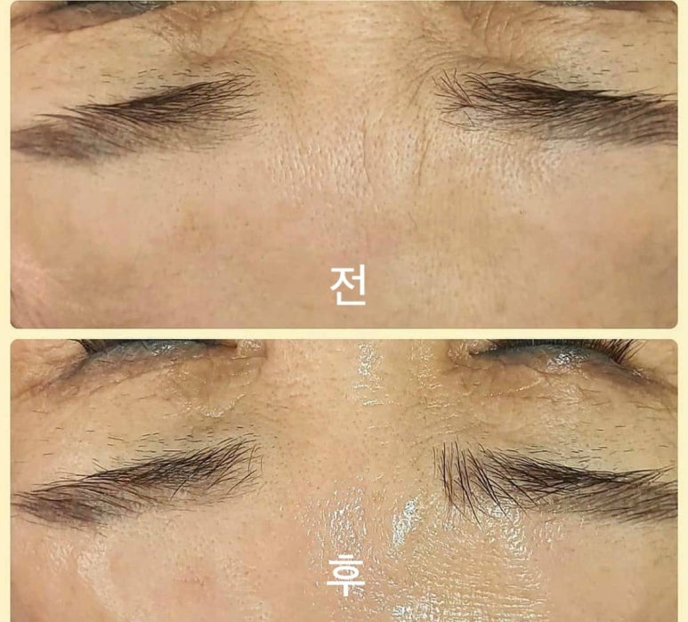 여기서하다 이미지