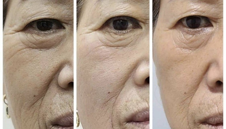 여기서하다 이미지
