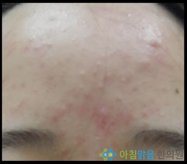 아침맑음한의원 이미지