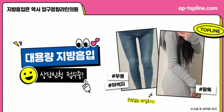 탑라인 이미지