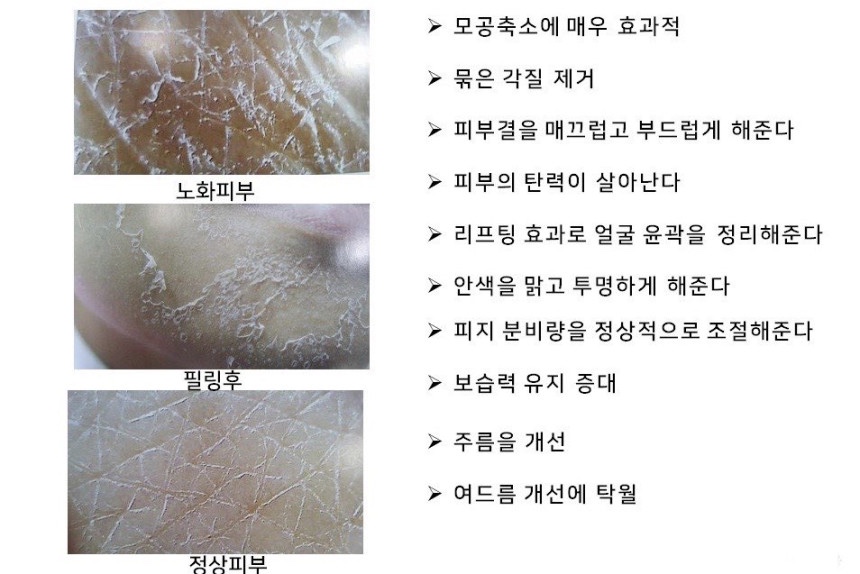 델라 에스테틱 이미지