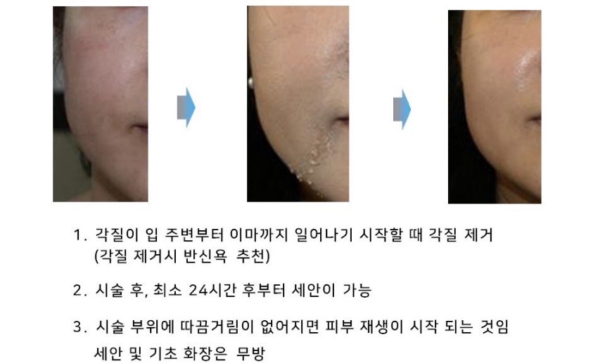 델라 에스테틱 이미지