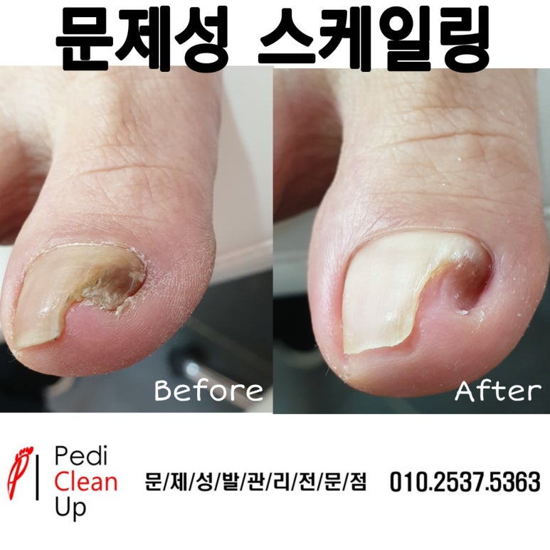 샵 손톱에물들다&페디클린업 이미지
