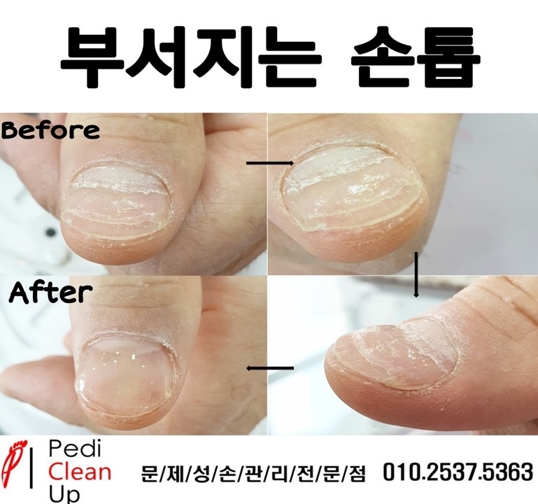 샵 손톱에물들다&페디클린업 이미지