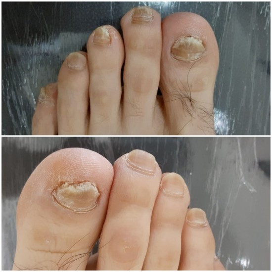 레푸스 앤 두두네일 이미지