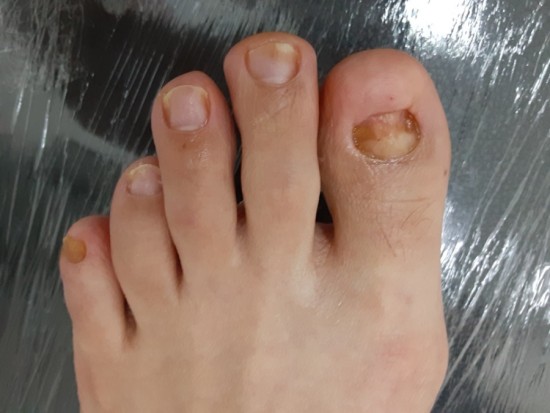 레푸스 앤 두두네일 이미지