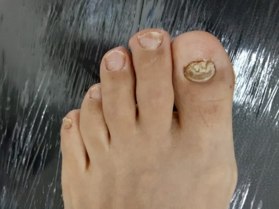 레푸스 앤 두두네일 이미지