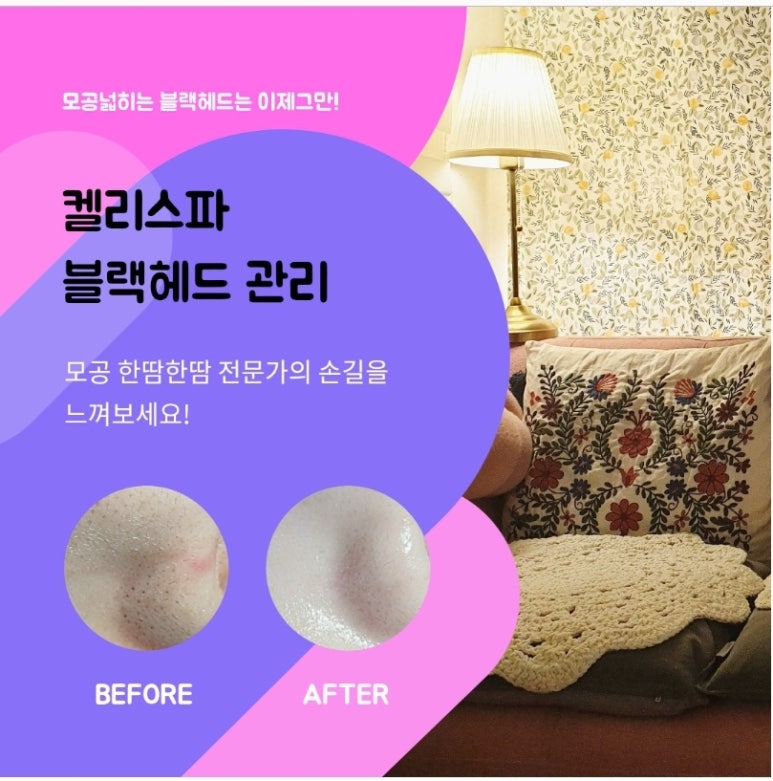 켈리스파 이미지