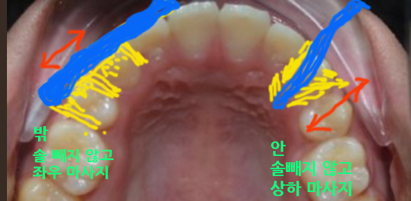 서울스타일치과의원 이미지