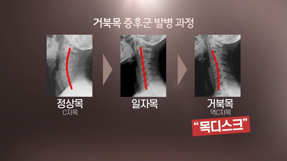 늘바른콘텐츠 이미지
