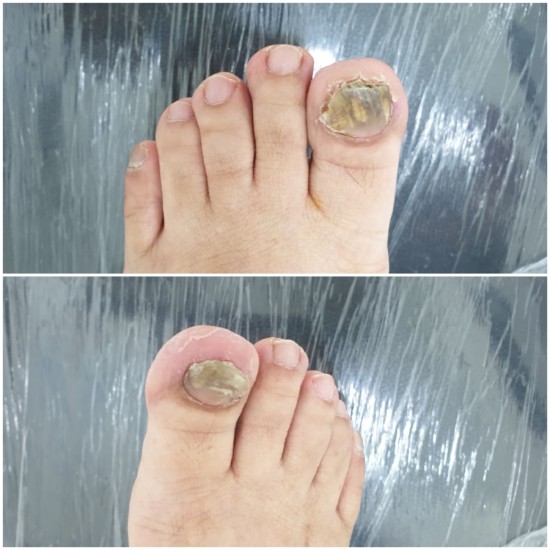 레푸스 앤 두두네일 이미지