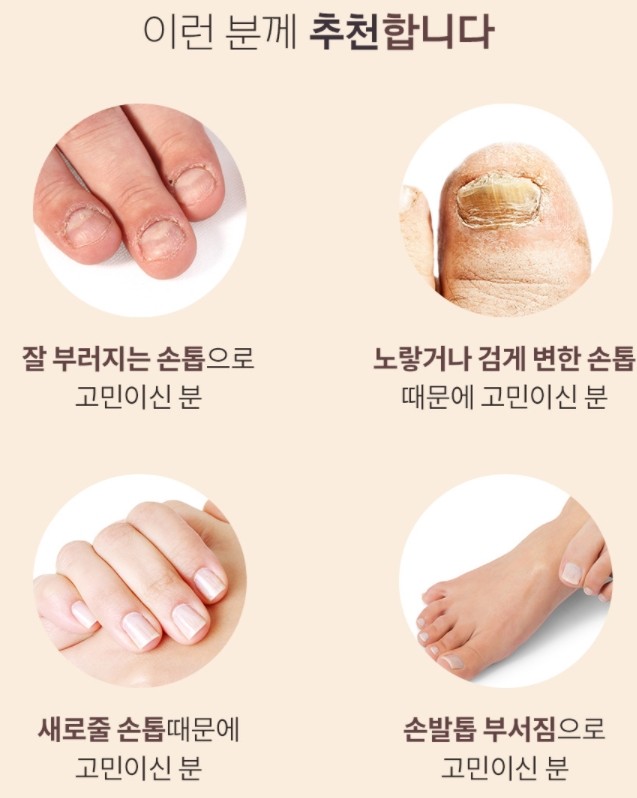 조아아로마 이미지