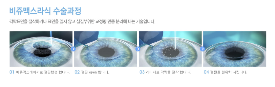 조은안과의원 이미지