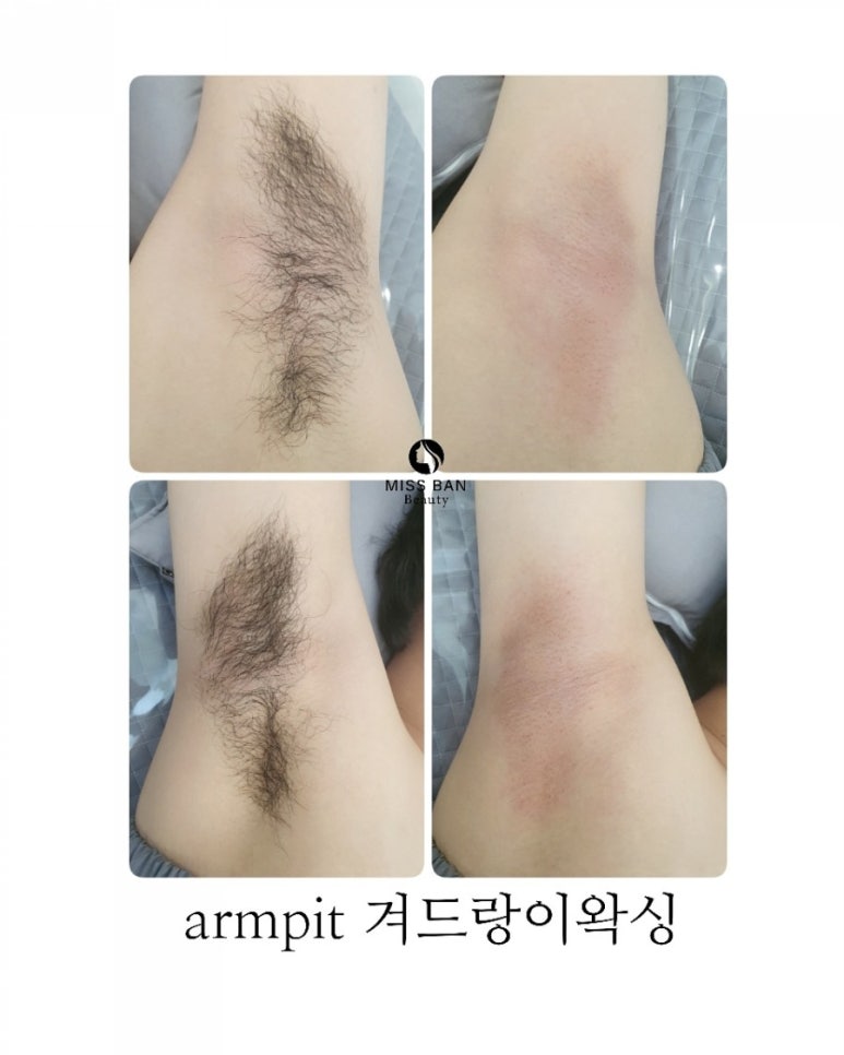 미쓰반뷰티 이미지