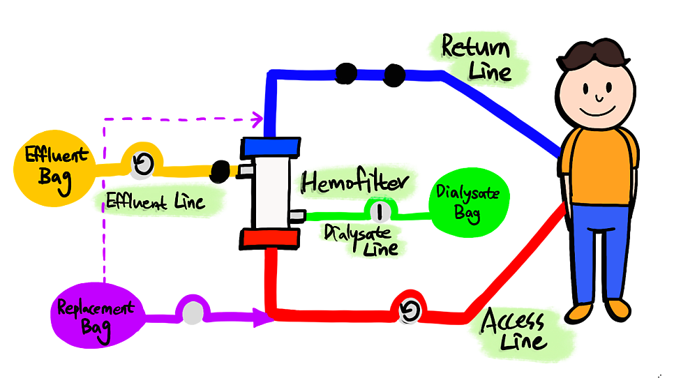 crrt-continuous-renal-replacement-therapy