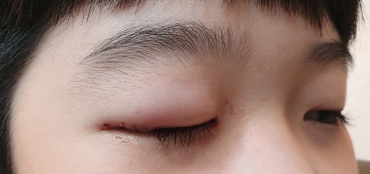 동탄서울안과 이미지