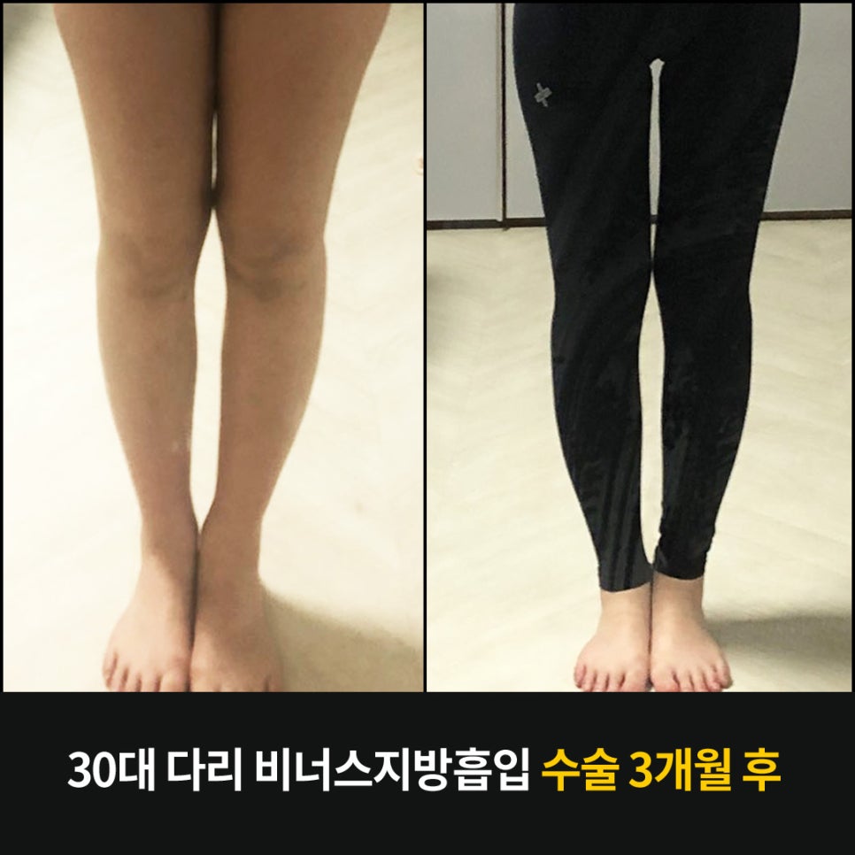 에이스타 이미지