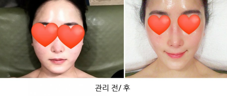썬플라워뷰티 이미지