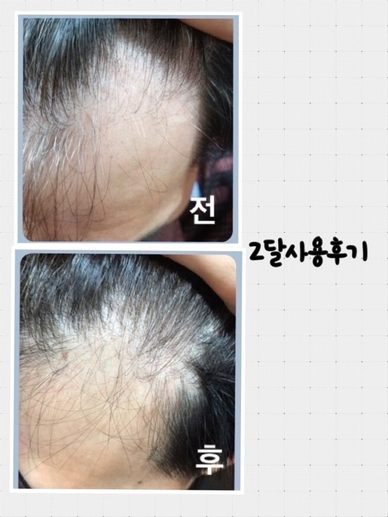 현헤어마루 이미지