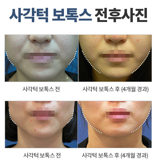리뉴미피부과 이미지