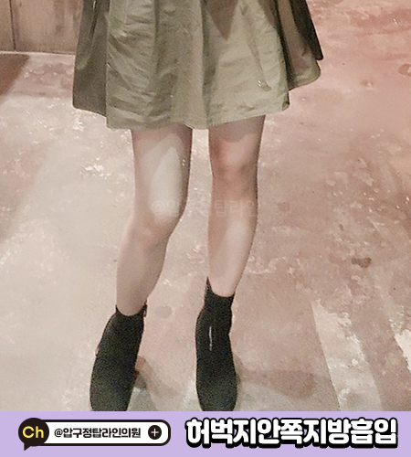 탑라인 이미지