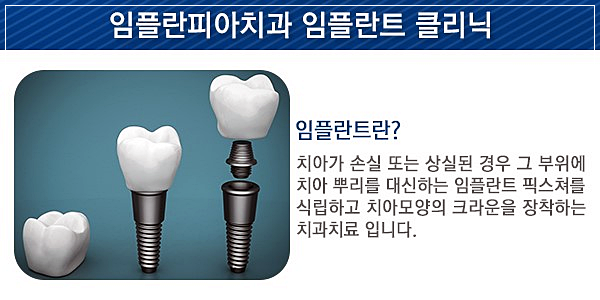 서울임치과의원 이미지