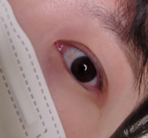 아이 엠(eye m) 이미지