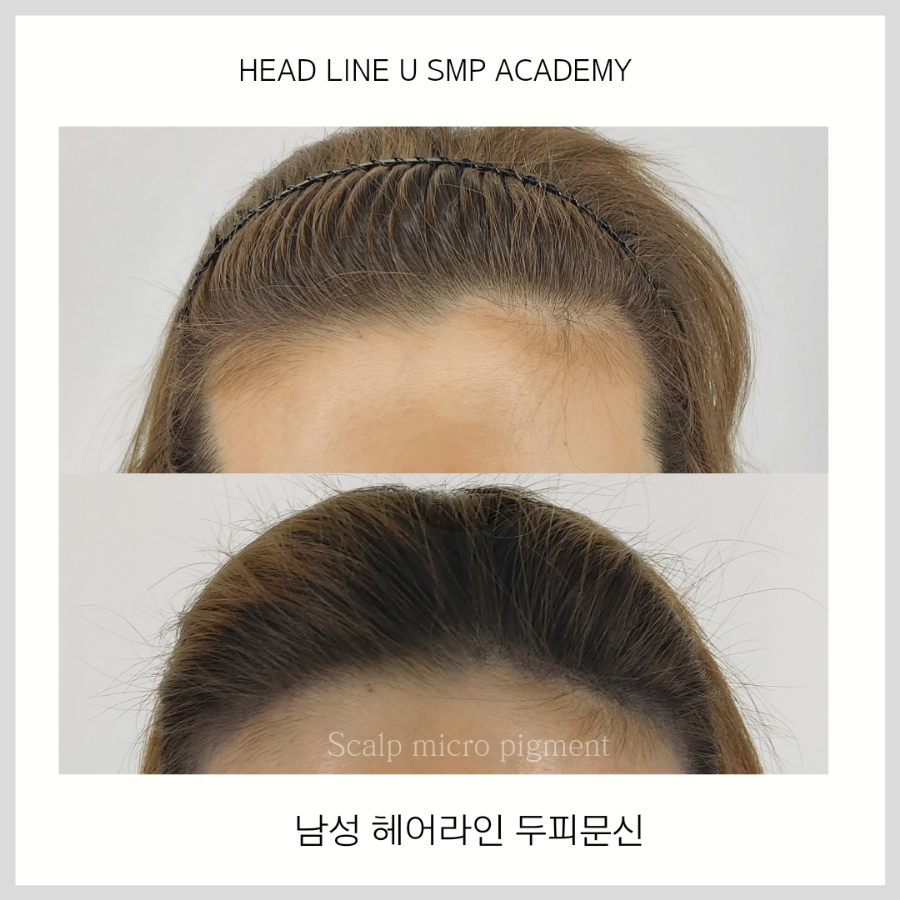 헤드라인유 이미지