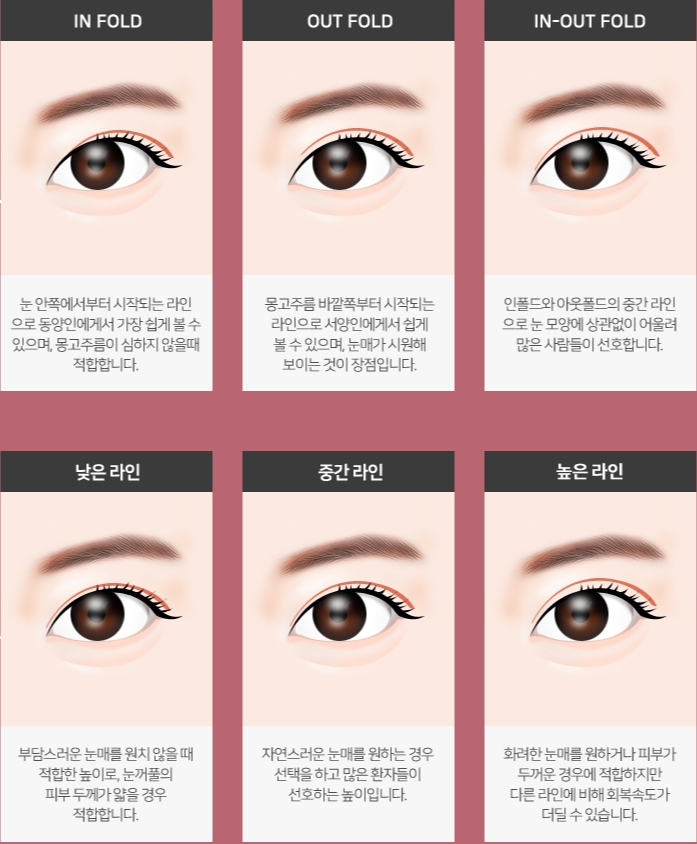 꼼꼼성형외과의원 이미지