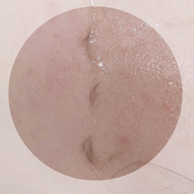 깐네일 이미지